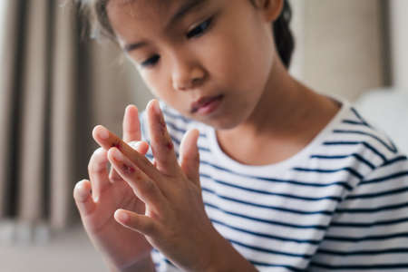 Fresh wound and blood from injured on child fingers after she has been an accident.の写真素材
