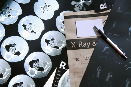 x-rayの写真素材
