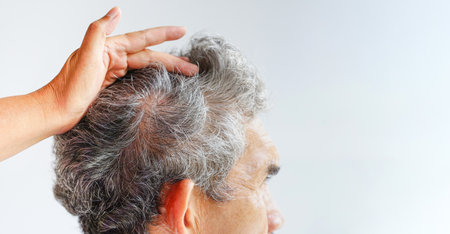 grey hair in an old age man(selective focus), beautician open gray hair of a senior man to show hair problem isolated on grey background with copy spaceの写真素材