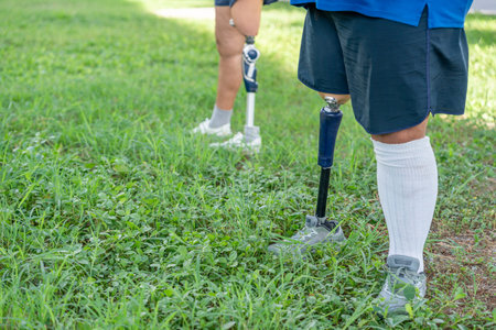 Two people with legs amputated wear prosthesis resting in the park after exercise