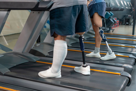 persons with prosthetic leg walking on treadmill,disabled athletes workout at indoors gym fitness...