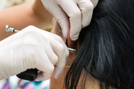 Puncture of the earの写真素材