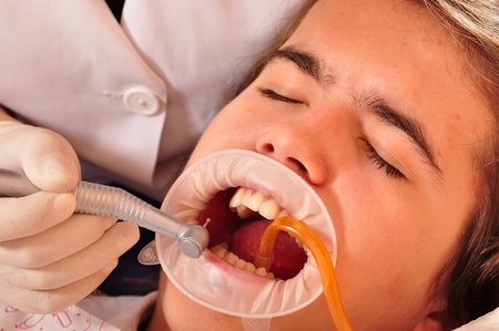 Photo of patient having his teeth healed.の写真素材