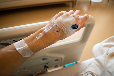 intravenous infusion hand 1の写真素材