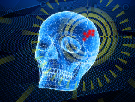 The abstract medical exam or research of the skull. The sight is aiming for the source of pain...