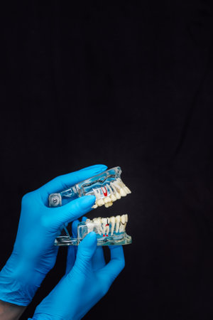 Dental demonstration model of the jaw in the hands of a surgeon.の写真素材