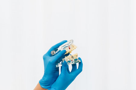 Dental demonstration model of the jaw in the hands of a surgeon.の写真素材
