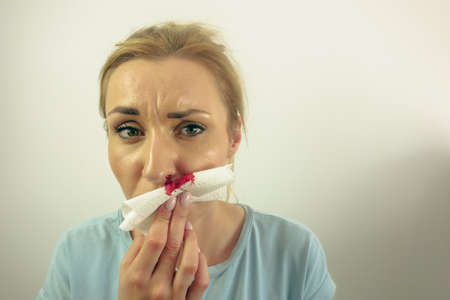 Nosebleed, a young woman with a bloody nose. Healthcare and medical concept. Copy space for designの写真素材