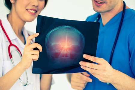 Female doctor looking at x ray film of patient head injury while working with another doctor at the hospital. Medical healthcare staff and doctor service.の写真素材