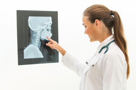 Female doctor working with x ray film of patient head and diagnose skull injury.の写真素材