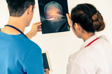 Female doctor looking at x ray film of patient head injury while working with another doctor at the hospital. Medical healthcare staff and doctor service.の写真素材