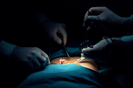 Closeup surgical team performing surgery to patient in sterile operating room. In a surgery room lit...