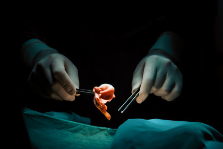 Closeup surgical team performing surgery to patient in sterile operating room. In a surgery room lit by a lamp, a professional and confident surgical team provides medical care to unconscious patient.の写真素材