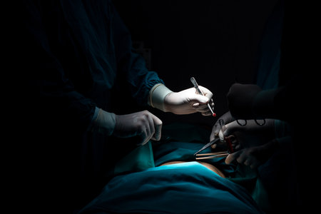 Closeup surgical team performing surgery to patient in sterile operating room. In a surgery room lit by a lamp, a professional and confident surgical team provides medical care to unconscious patient.の写真素材