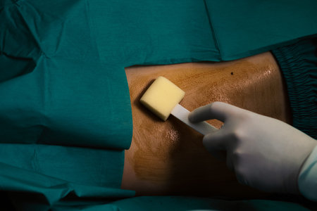 Doctor or surgeon apply betadine to the patient for anesthesia injection to reduce pain before...