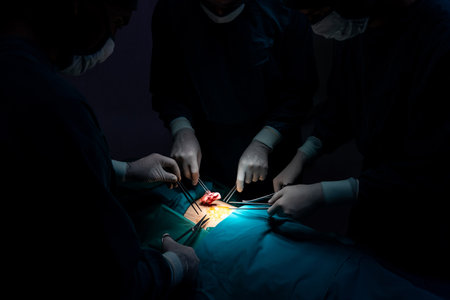Closeup surgical team performing surgery to patient in sterile operating room. In a surgery room lit by a lamp, a professional and confident surgical team provides medical care to unconscious patient.の写真素材