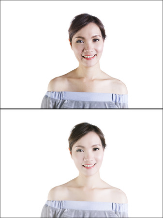 Woman with spotty skin with deep pores and blackhead and healed soft skin. befor and afterの写真素材