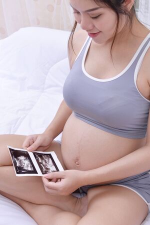 Women are pregnant looking at the baby's ultrasound image.