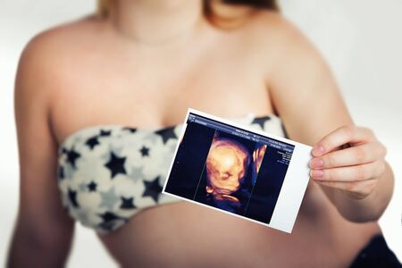 Pregnant woman holding ultrasound photo of the blur backgroundの写真素材