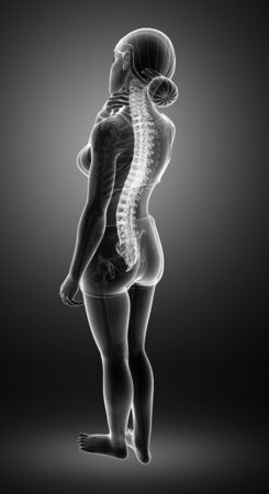 3d Illustration of Women Feeling the Back painの写真素材