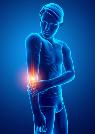 3d Illustration of Men Feeling Elbow painの写真素材