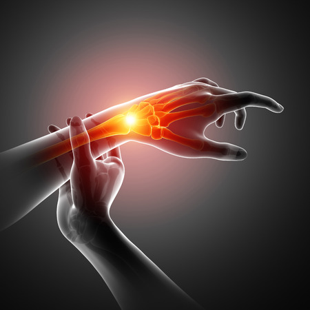 3d Illustration of Men Feeling the Wrist Painの写真素材