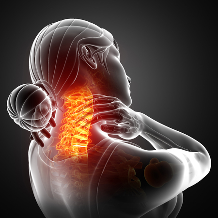 3d Illustration of Women Feeling the Neck Painの写真素材