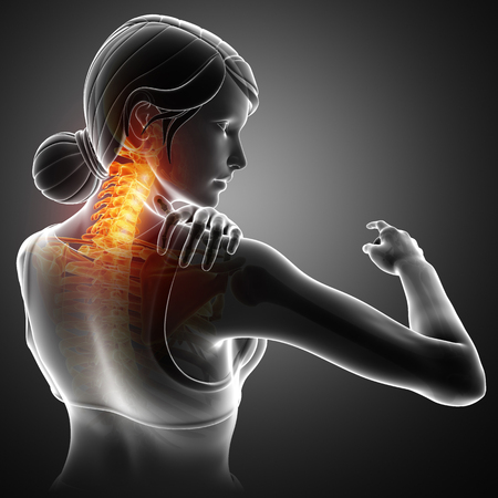 3d Illustration of Women Feeling the Neck Painの写真素材