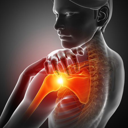 3d Illustration of Male Feeling the Shoulder Painの写真素材