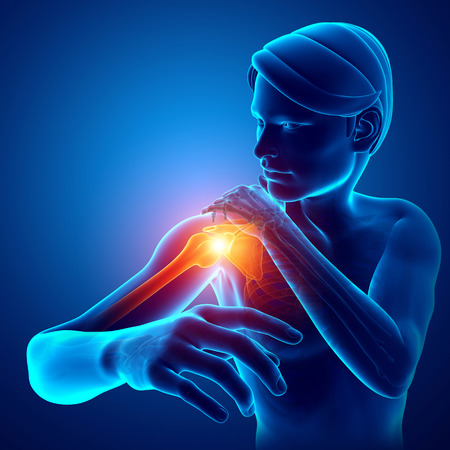 3d Illustration of Male Feeling the Shoulder Painの写真素材