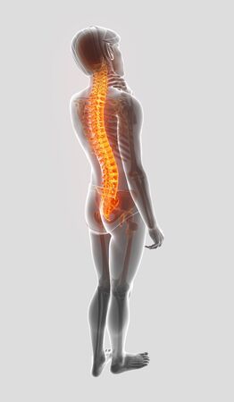 3D Illustration of male Feeling the back painの写真素材