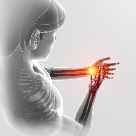 3d Illustration of Men Feeling Elbow painの写真素材