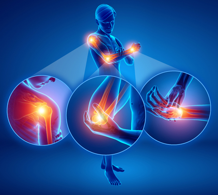 3d Illustration of Men Feeling Arm joint painの写真素材