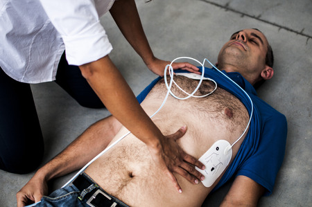girl applies defibrillator electrodes to unconscious manの写真素材