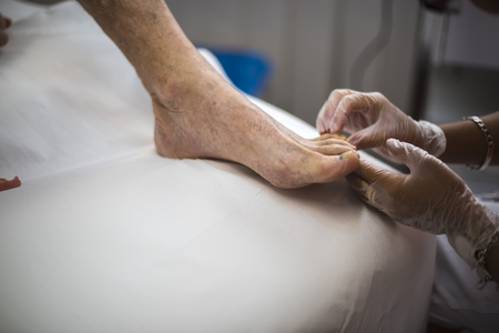 podiatry doctor curing an elderly patient footの写真素材