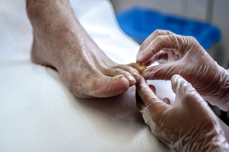 podiatry doctor curing an elderly patient footの写真素材
