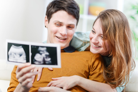 Beautiful couple watching with emotion ultrasound pictures of their babyの写真素材