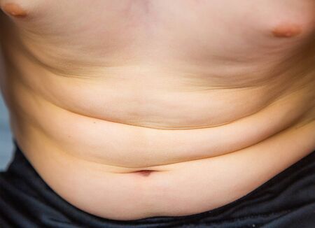 Close-up of a child's belly showing overweight and early signs of obesityの写真素材