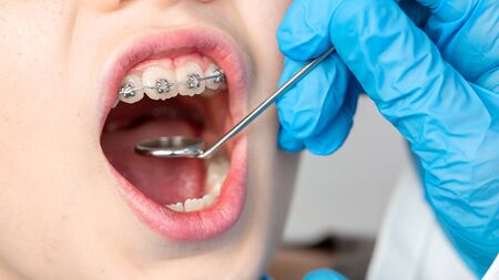 Closeup of dentist using an instrument to visualize the teeth of a child patient