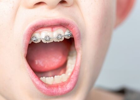 Closeup of dentist using an instrument to visualize the teeth of a child patientの写真素材