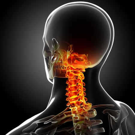 3d rendered medical x-ray illustration of Human Neck pain anatomyの写真素材
