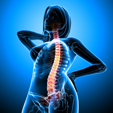 Back pain of female body Back pain of female body