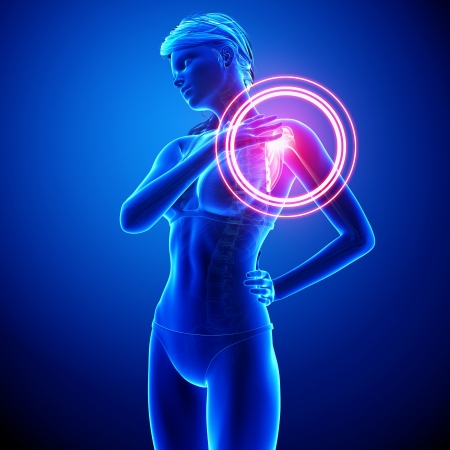Illustration of female shoulder pain anatomy in blueの写真素材