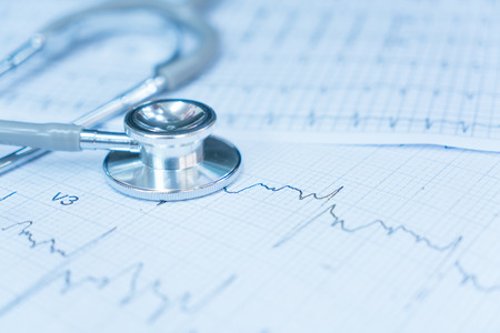 Stethoscope on electrocardiogram.
