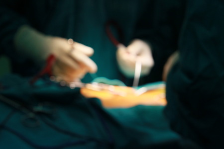 Doctors perform surgery patientの写真素材