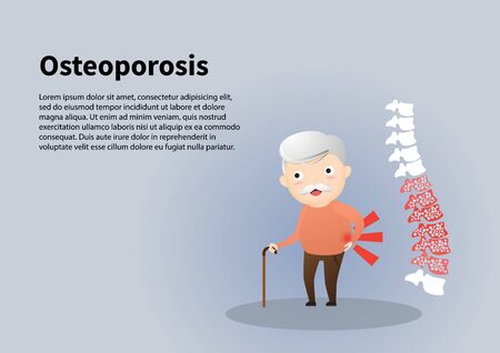Old man with osteoporosis. vector,  illustration.のイラスト素材