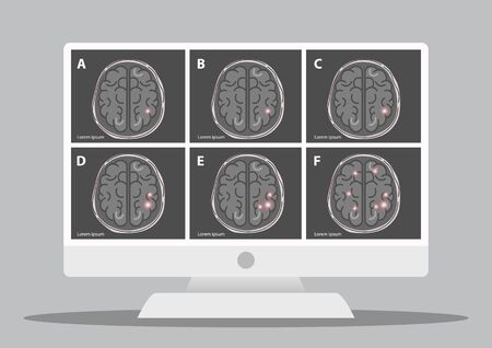 A team of doctors is diagnosing the brain.  Mental health concept. Solving mental problems. Psychotherapy and help. Flat vector illustration.のイラスト素材