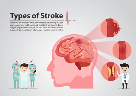 Teamwork of doctors is diagnosing the brain.  Mental health concept. Solving mental problems. Psychotherapy and help. Flat vector illustration.のイラスト素材