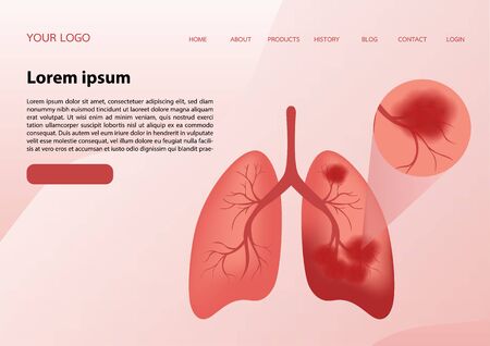 Stroke disease, hemorrhagic. Scientific medical illustration of human brain stroke illustration. illustration, vector.
のイラスト素材
