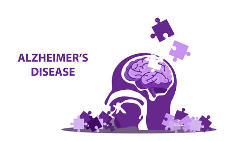 Scientific medical illustration of human brain stroke illustration. Types of human brain stroke illustration. vector, espのイラスト素材